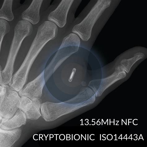 buy rfid chip implant|RFID & NFC human chip implants .